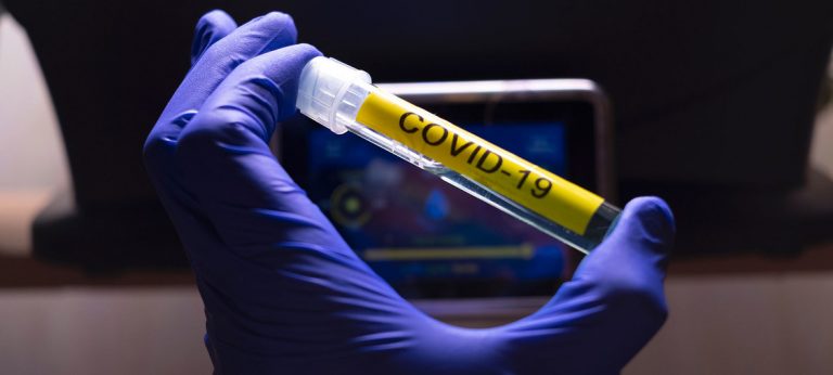 New coronavirus in Costa Rica: 713 infections; country reached capacity for 2,500 daily tests