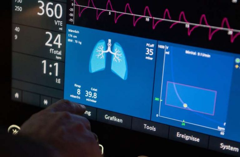 Some covid-19 patients taken off ventilators are taking days or even weeks to wake up